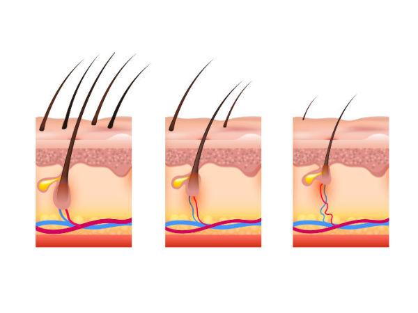 Natural Life Cycle Of Hair