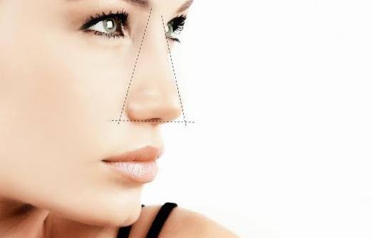 Rhinoplasty